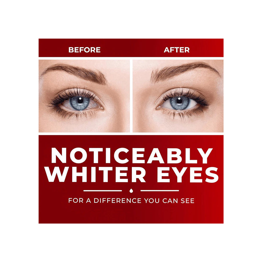 Clear Eyes Maximum Redness Relief (15ml)