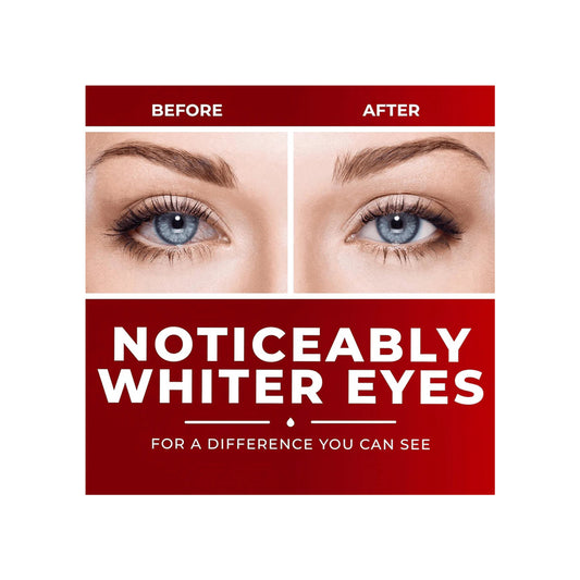 Clear Eyes Maximum Redness Relief (15ml)